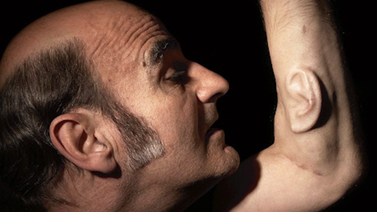 Stelarc, side on photo of the head and raised forearm of a balding man with long sideburns who has an ear growing out of his arm.